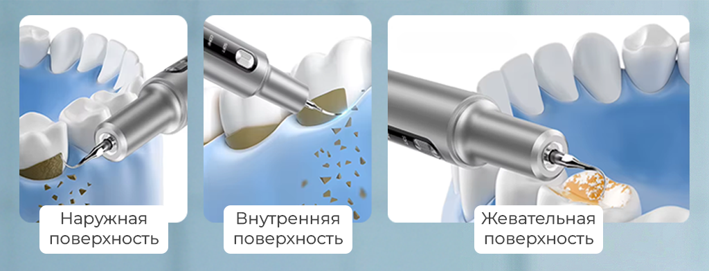 SenCiciMen Electric Teeth Cleaner (SCMT10)-рич-3.png